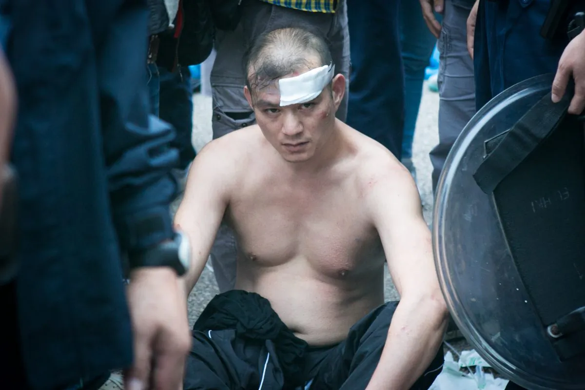 One of the anti-protesters who threw animal body parts on Apple Daily owner Jimmy Lai, has a bandage on his head after pro-democracy protesters jumped on him until the police came at the central District protest site in Hong Kong on Nov. 12, 2014. (Benjamin Chasteen/Epoch Times)