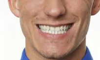A Rundown on Dental Fillings