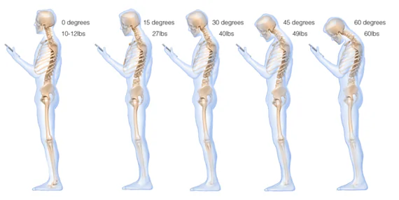 What Texting Does to the Spine