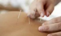 7 Top Reasons to Try Acupuncture