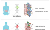 Study Reveals That People May Inherit ‘Gut’ Bacteria That Cause Crohn’s Disease and Ulcerative Colitis