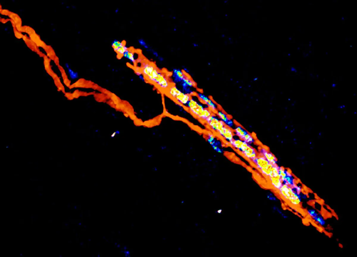 Sensory nerve terminals (orange) of a muscle spindle. University of Basel, Biozentrum)