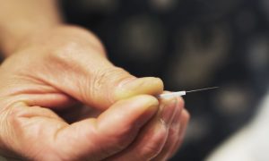 Acupuncture Eases Alcohol Cravings