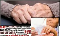 Siberian Scientists May Be on Brink of Parkinson’s Cure