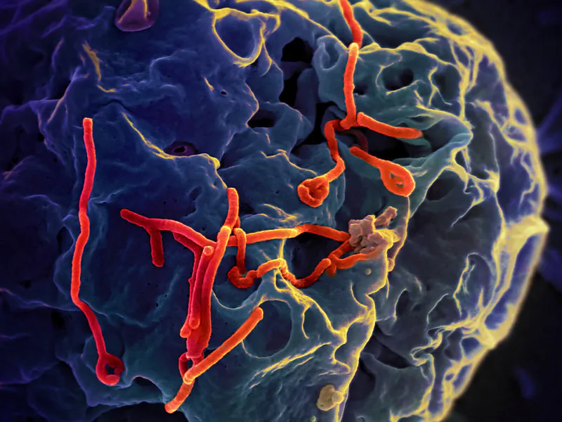 Ebola close up. (NIAID, CC BY*)