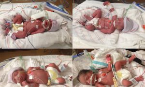 Mom Carrying Quadruplets Learns One Is Dying in Womb, So She Makes a Tough Choice