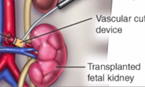 Will Americans Accept Organ Transplants From Aborted Fetuses?