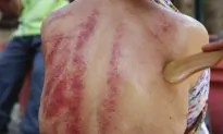 Ancient Technique Scrapes Away Pain