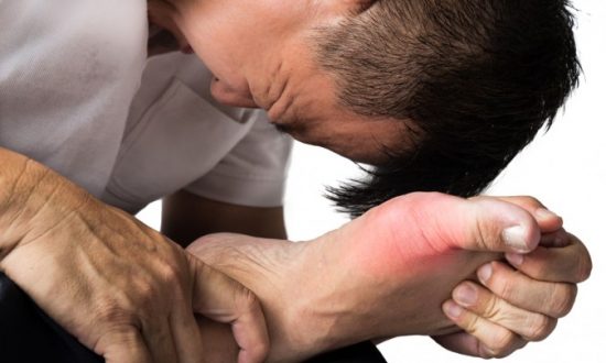 How to Cure Gout Naturally