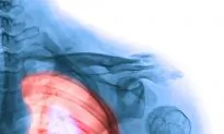 Radon’s Link to Lung Cancer