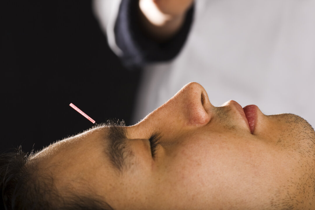 Believing acupuncture would work helped improve the outcome of treatments for patients with low back pain. (Mark Fairey/iStock/Thinkstock)