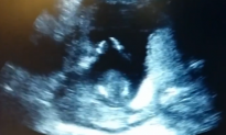 Ultrasound Baby Claps Along With Mother’s Song (Video)
