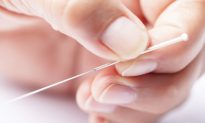 Acupuncture Lowers High Cholesterol