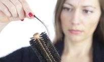 Health Check: Why Does Women’s Hair Thin Out?