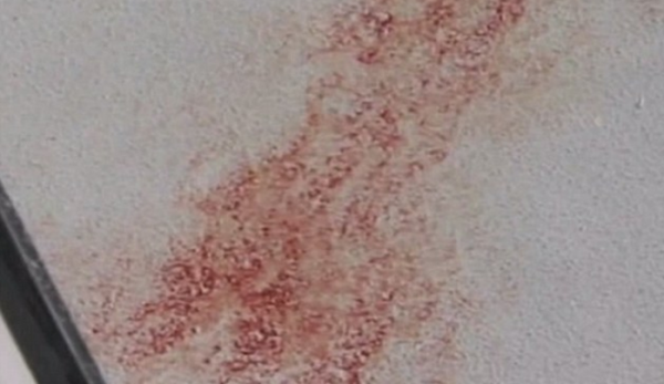 Blood from the attack on the deck of Carlin's boat. (ABC 10)