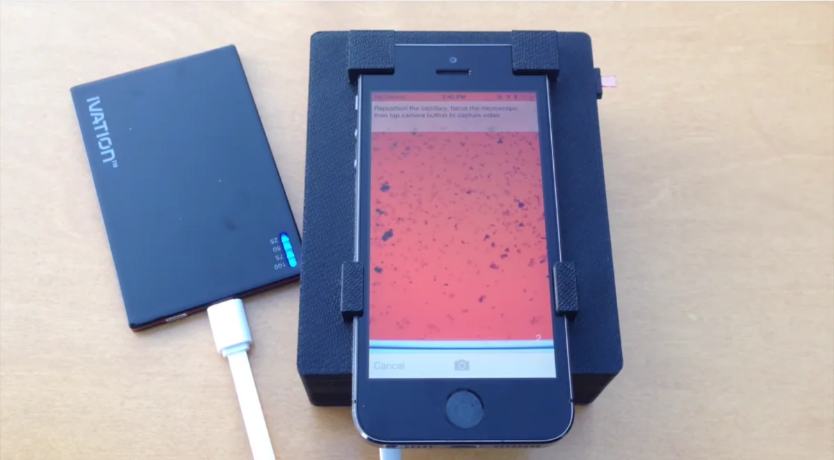 A smartphone analyzes a blood sample for parasites (Mike D’Ambrosio and Matt Bakalar, Fletcher Lab, UC Berkeley)