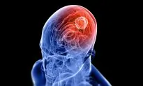 5 Ingredients That Poison Your Brain