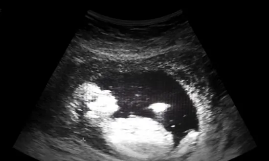 Pre-Birth Memories: Can People Remember Being in the Womb? Being Born?