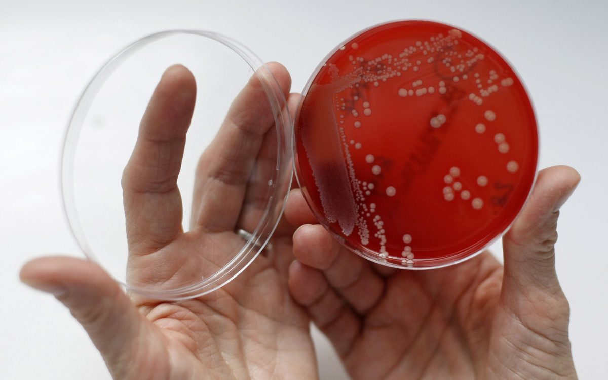 MRSA (Methicillin-resistant Staphylococcus aureus) bacteria strain in a petri dish containing agar jelly. MRSA is a drug-resistant “superbug,” which can cause deadly infections. (REUTERS/Fabrizio Bensch)