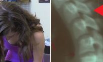 Teen Girl Gets Diagnosed with ‘Text Neck’
