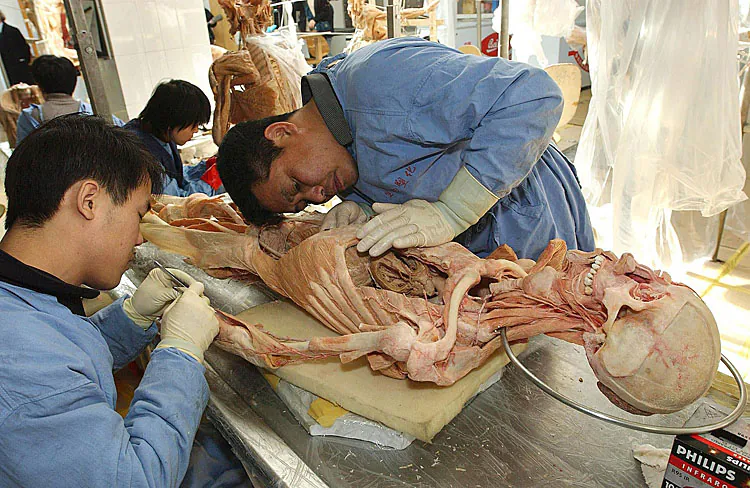 Chinese dissection experts prepare a human body at the Von Hagens Plastination factory in Dalian, on Feb. 2, 2004. Von Hagens opened the first plastination factory in Dalian, but was soon followed by several imitators. (STR/AFP/Getty Images)