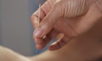 Finally, Acupuncture Proven to Reduce Pain