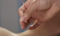 Stanford University: Acupuncture Reduces Pain After Surgery