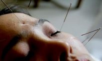 Acupuncture and Chinese Medicine for Mental Health, Part 1