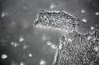 Federal Stem Cell Ban: Great for California