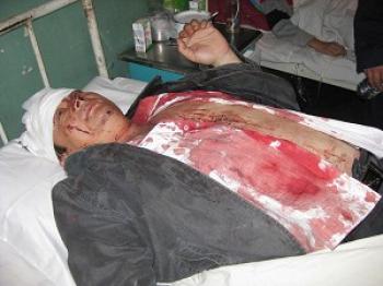 A hospitalize villager severely injured after hired thugs beat him. (Local villager) A hospitalize villager severely injured after hired thugs beat him. (Local villager)