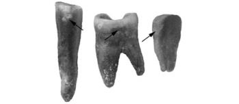 NEANDERTHAL COOKING: Researchers found direct evidence that Neanderthals cooked vegetables. (Courtesy of George Washington University)