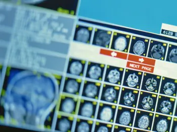 ‘Movies’ in the Mind Revealed by Brain Imaging