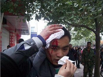 A beaten protester Photo provided by mainland China Internet surfer (Photo provided by mainland China Internet surfer) A beaten protester Photo provided by mainland China Internet surfer (Photo provided by mainland China Internet surfer)