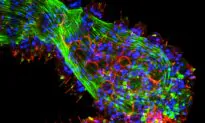 SCIENCE IN PICS: How the Eyeless Hydra Sees