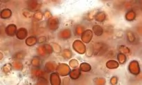 Red Rain in India May Have Alien Origin