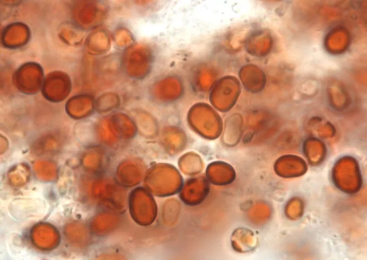 A red cell as seen with transmission electron microscopy. (Godfrey Louis/CUSAT)