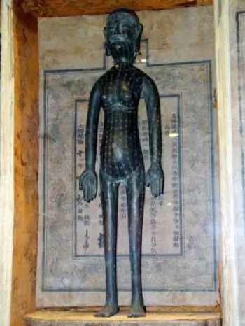 Acupuncture points on a Qing Dynasty bronze statue. (The Epoch Times)