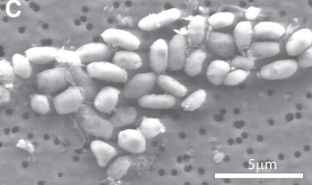 LIVING IN A DIFFERENT WAY: Bacterium strain GFAJ-1 grew while provided with arsenic instead of phosphorus. (Courtesy of Science/AAAS) LIVING IN A DIFFERENT WAY: Bacterium strain GFAJ-1 grew while provided with arsenic instead of phosphorus. (Courtesy of Science/AAAS)