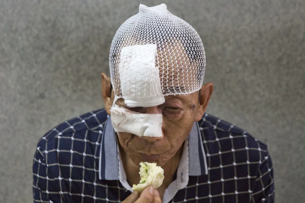 A man with his wounds bandaged eats a bun in a hospital receiving victims of an explosion in northeastern China's Tianjin municipality on Thursday, Aug. 13, 2015. (AP Photo/Ng Han Guan)