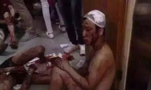 Substandard Window Glass Increased the Injury Count in Tianjin's Harbor Explosion