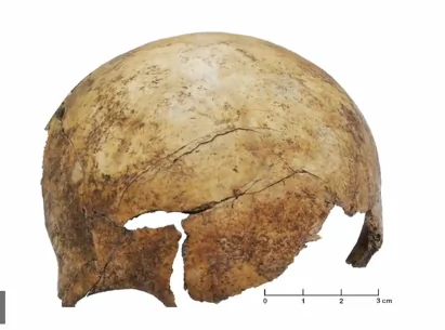 Prehistoric Mass Grave Contained Brutally Beaten Victims (Video)