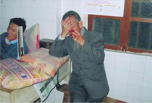 A villager wounded in the shooting in Shanwei, China. (The Epoch Times) A villager wounded in the shooting in Shanwei, China. (The Epoch Times)