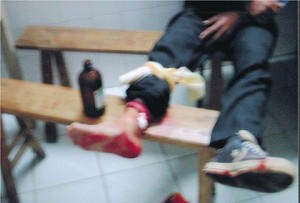 A villager wounded in the shooting in Shanwei, China. (The Epoch Times) A villager wounded in the shooting in Shanwei, China. (The Epoch Times)