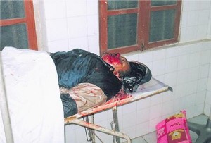 A villager wounded in the shooting in Shanwei, China. (The Epoch Times) A villager wounded in the shooting in Shanwei, China. (The Epoch Times)