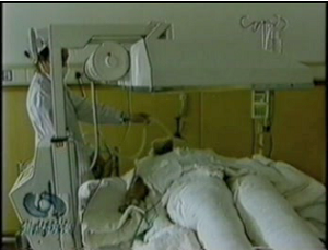 This still image taken from China Central Television's own footage purports to show 12-year-old Liu Siying receiving treatment for burns sustained from self-immolation, however, the girl is wrapped heavily in gauze, contrary to standard practice of serious burn patients. (NTDTV's False Fire video, showing footage from China Central Television)