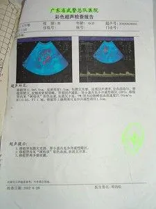 Illegal Kidney Transplant in Mainland Hospital