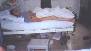 Ren Chuanlan was reduced to skin and bones and died due to complications from illegal medical experiments.
