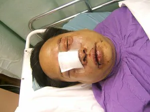 Prominent Hong Kong Democrat Attacked After Protest