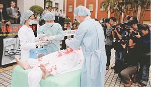 Re-enactment of Chinese communist regime removing organs from a living Falun Gong practitioner. (The Epoch Times)