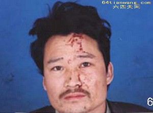 Xia received severe beatings on February 27. (64Tianwang.com)